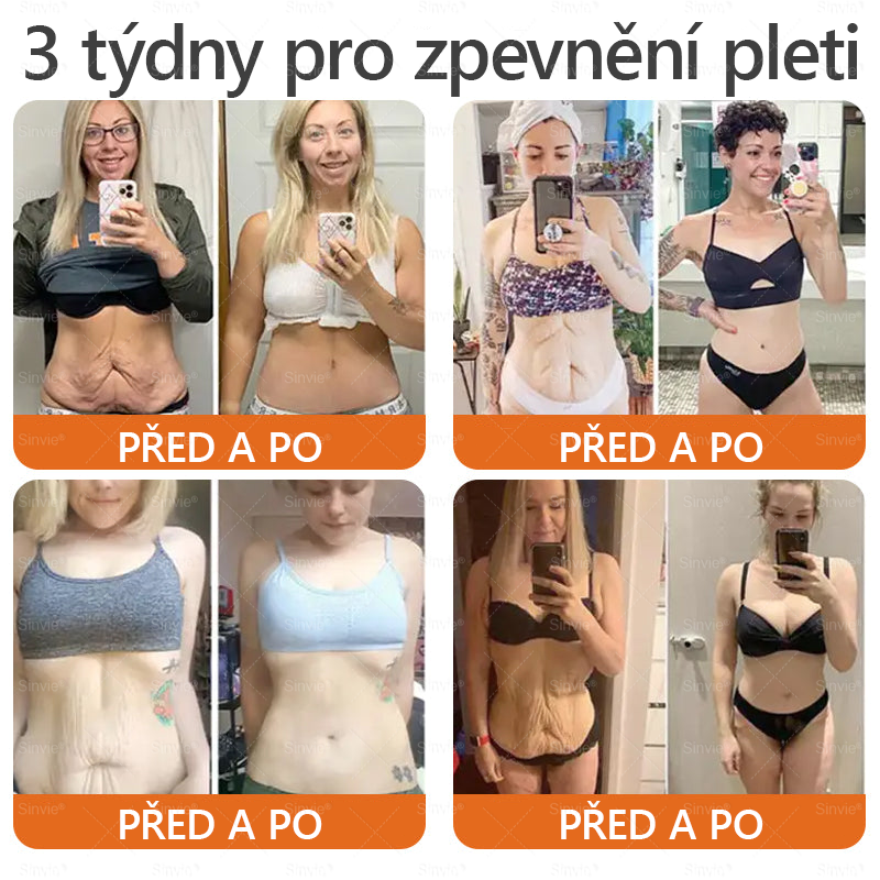 🌱 Odporúčané dermatológmi 🐝 ✨ PuraCure® Obnovujúci pleťový krém s včelím jedom 🔥 Český vývoj, výroba a doručenie v rámci Slovenska