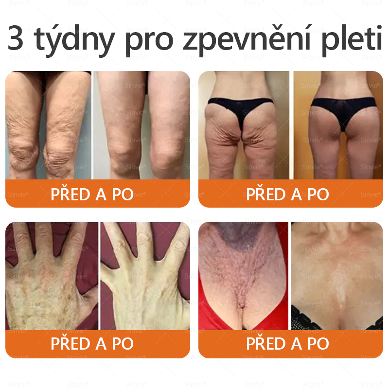 🌱 Odporúčané dermatológmi 🐝 ✨ PuraCure® Obnovujúci pleťový krém s včelím jedom 🔥 Český vývoj, výroba a doručenie v rámci Slovenska