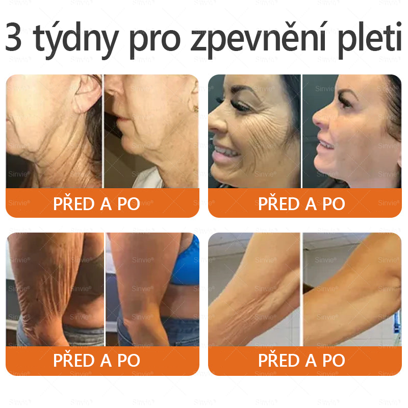 🌱 Odporúčané dermatológmi 🐝 ✨ PuraCure® Obnovujúci pleťový krém s včelím jedom 🔥 Český vývoj, výroba a doručenie v rámci Slovenska