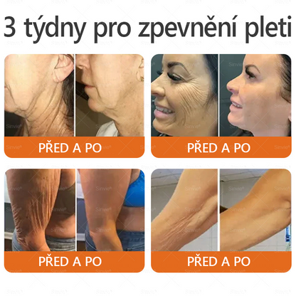 🌱 Odporúčané dermatológmi 🐝 ✨ PuraCure® Obnovujúci pleťový krém s včelím jedom 🔥 Český vývoj, výroba a doručenie v rámci Slovenska