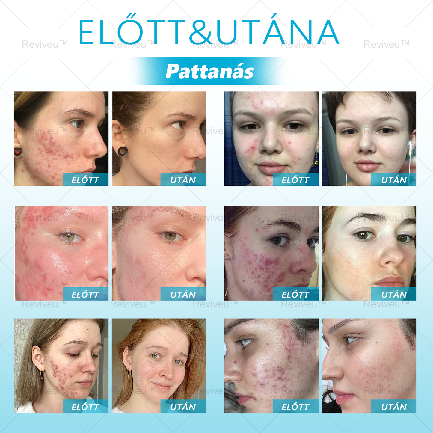 🐍🐍🐍Reviveu™ Revitalizáló Krém (Jelentős javulás 7 napon belül💯)