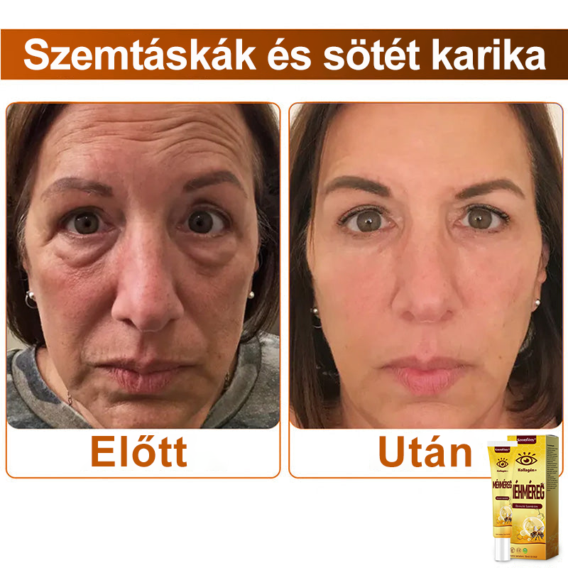💛SzemFény™ Kollagén+ Méhméreg Ébresztő Szemkrém - Bőrgyógyász Által Ajánlott - CE minősítést szerzett