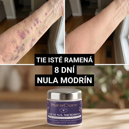 SVK🌿👉 100 000+ predaných kusov 💁‍♀️ – PuraCure® Regeneračný krém na modriny a spevnenie pokožky