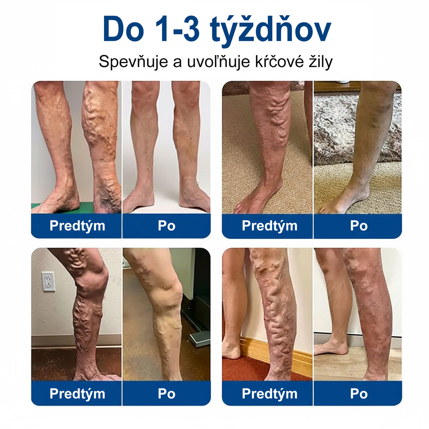 🇺🇸👨‍⚕️✅ Medistart® VeinRepair – mikrotűs ápoló tapasz ⚡ Azonnali megkönnyebbülés, hosszan tartó eredmény