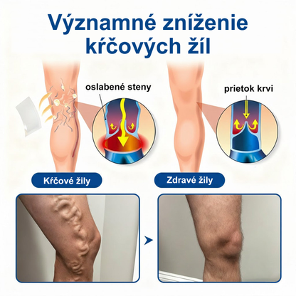 🇺🇸👨‍⚕️✅ Medistart® VeinRepair – mikrotűs ápoló tapasz ⚡ Azonnali megkönnyebbülés, hosszan tartó eredmény