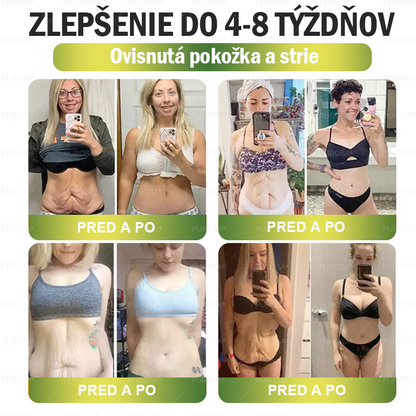 🎉 Gratulujeme! Dnes ste jednou zo šťastných zákazníčok. 🎁 Ako špeciálny darček získavate extra 50 % zľavu! Začnite už dnes s CrazyLeaf® a vykročte k zdravšiemu a krajšiemu životu. 🌿✨