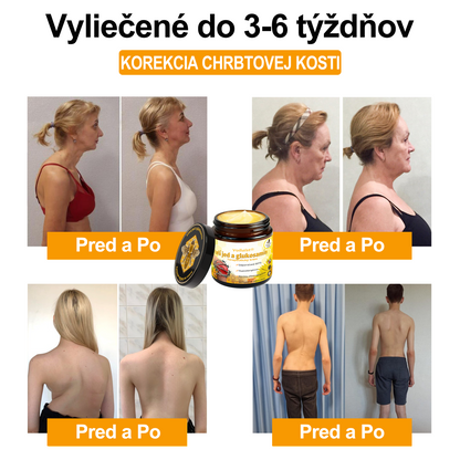 Voilaist® Terapeutický krém s včelím jedom a glukozamínom(Určené pre ľudí v strednom a staršom veku)