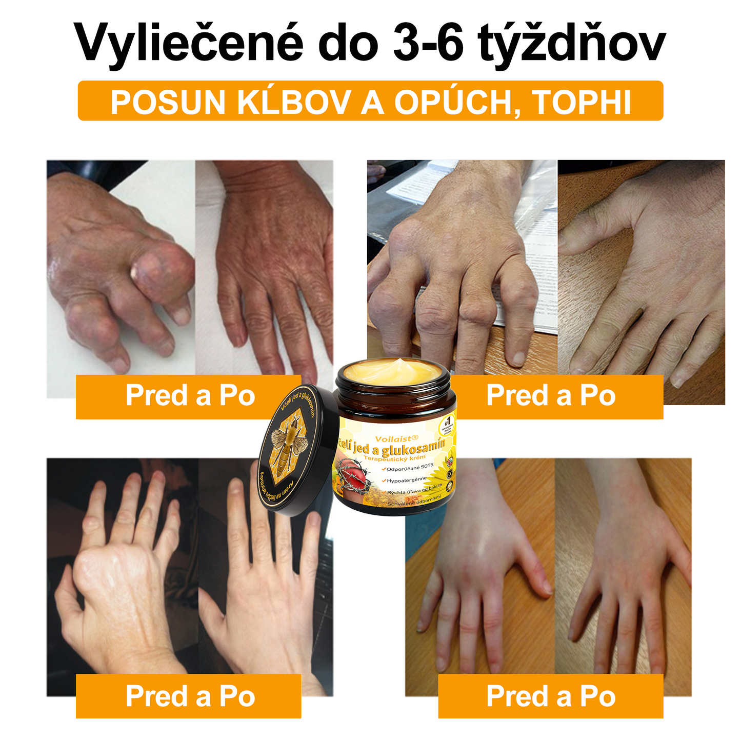 Voilaist® Terapeutický krém s včelím jedom a glukozamínom(Určené pre ľudí v strednom a staršom veku)