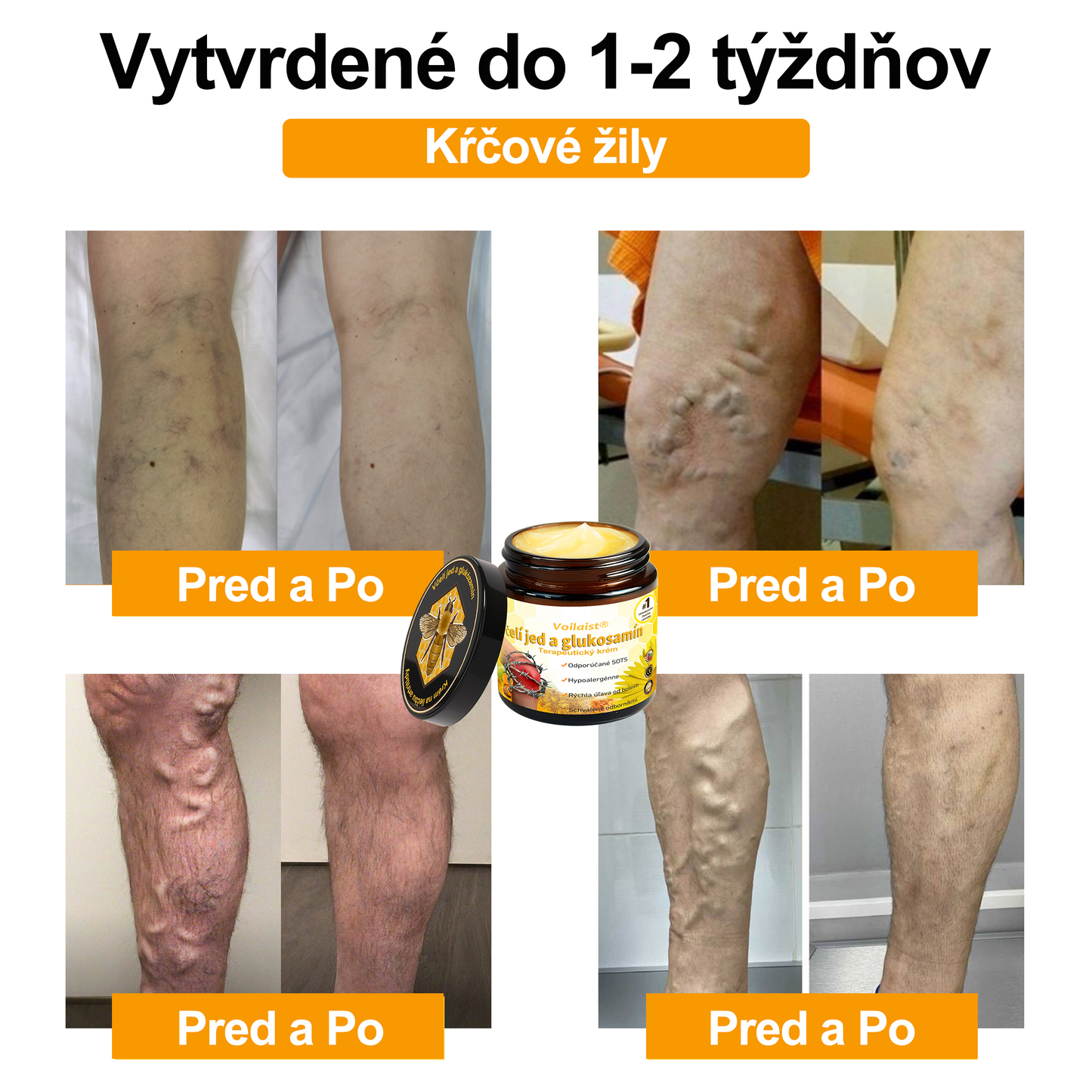 Voilaist® Terapeutický krém s včelím jedom a glukozamínom(Určené pre ľudí v strednom a staršom veku)