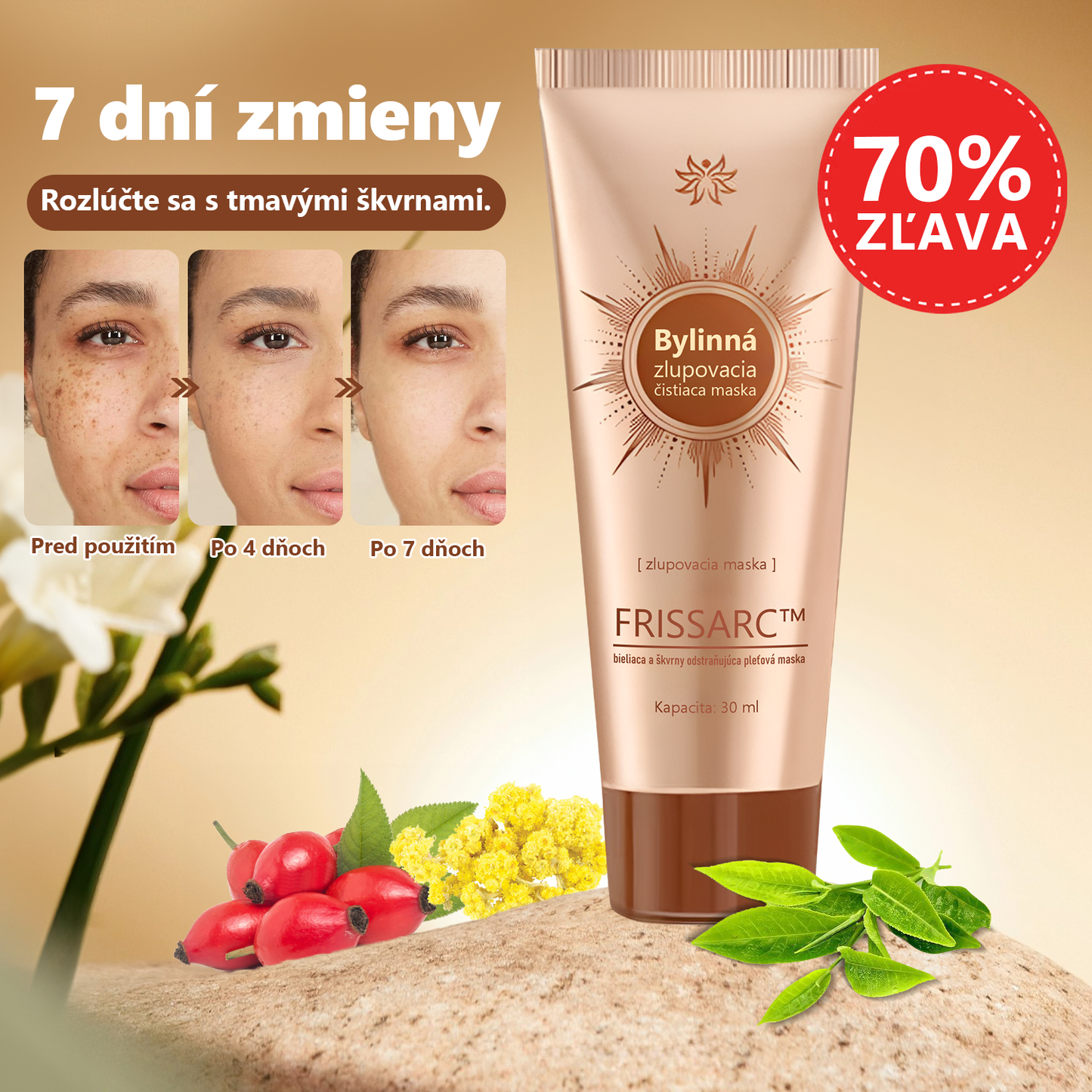 FRISSARC™ bieliaca a škvrny odstraňujúca pleťová maska – Prírodné zložky trvalo odstraňujú pigmentové škvrny, starecké škvrny, pehy a slnečné škvrny.