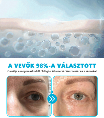 🐍🐍🐍Reviveu™ Revitalizáló Krém (Jelentős javulás 7 napon belül💯)