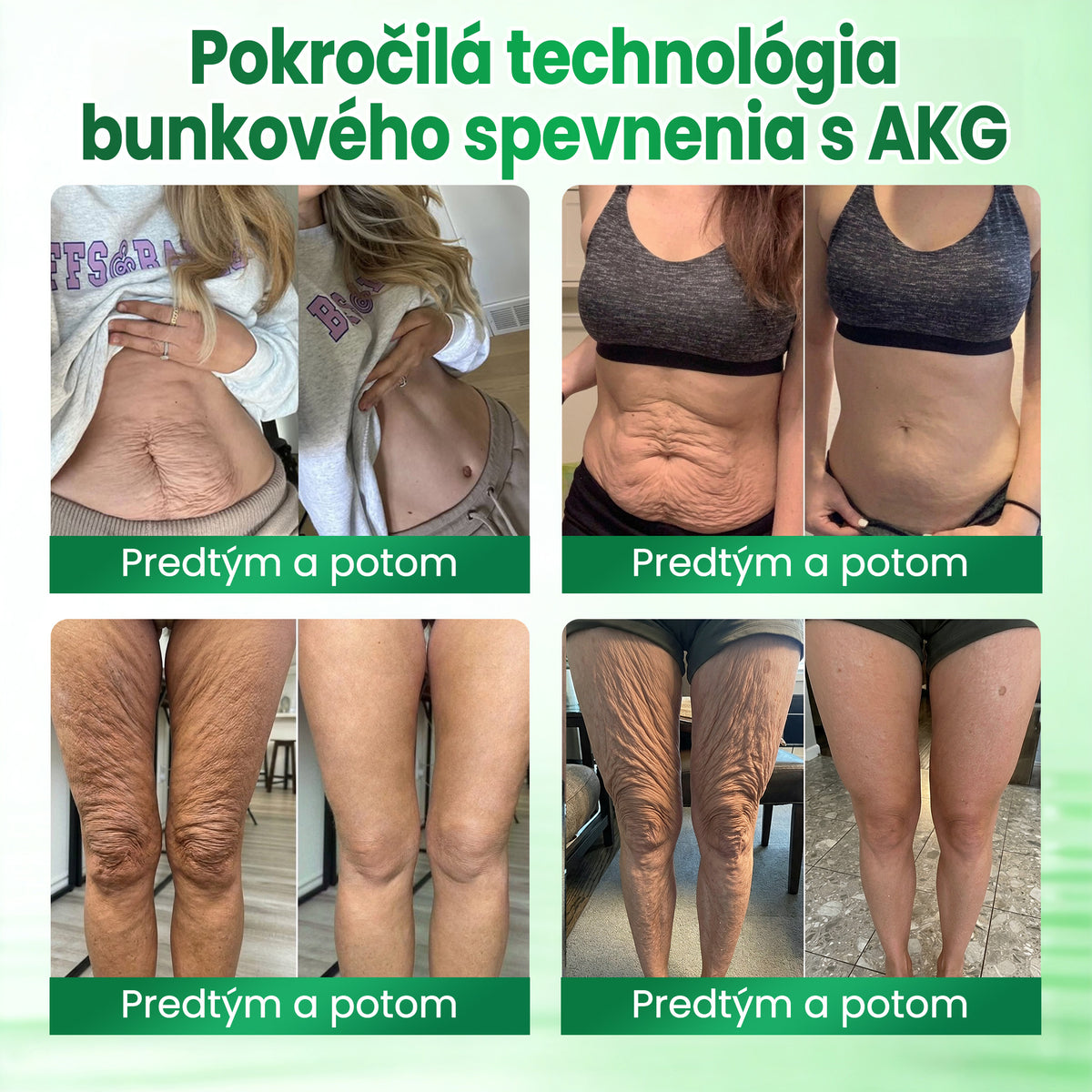 🎯Medistart® SPEVŇUJÚCA & PROTI STARNUTIU PLEŤOVÁ STAROSTLIVOSŤ