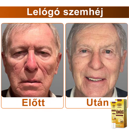 💛SzemFény™ Kollagén+ Méhméreg Ébresztő Szemkrém - Bőrgyógyász Által Ajánlott - CE minősítést szerzett