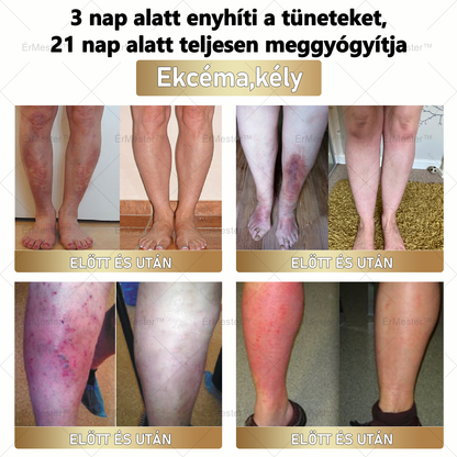 🏆 ÉrMester™  Természetes Vénás Javító Lábfürdő Gélgolyók