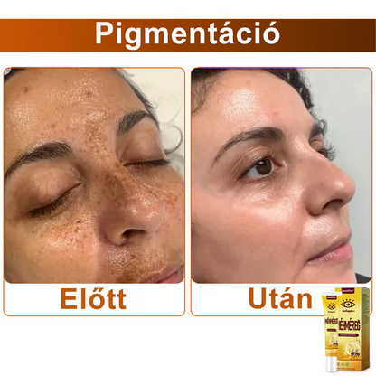 💛SzemFény™ Kollagén+ Méhméreg Ébresztő Szemkrém - Bőrgyógyász Által Ajánlott - CE minősítést szerzett