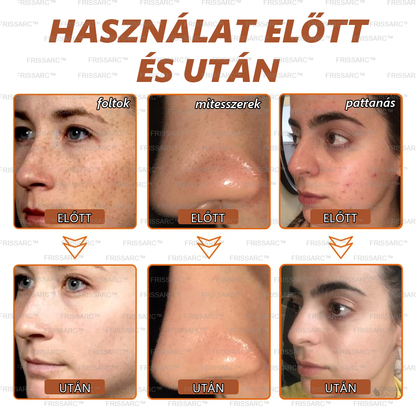 💥 FRISSARC™ Fehérítő és Pigmentfolt Eltávolító Maszk（🔥Búcsúzz el a pigmentfoltoktól, élvezd a sima, tökéletes bőrt! 🔥）