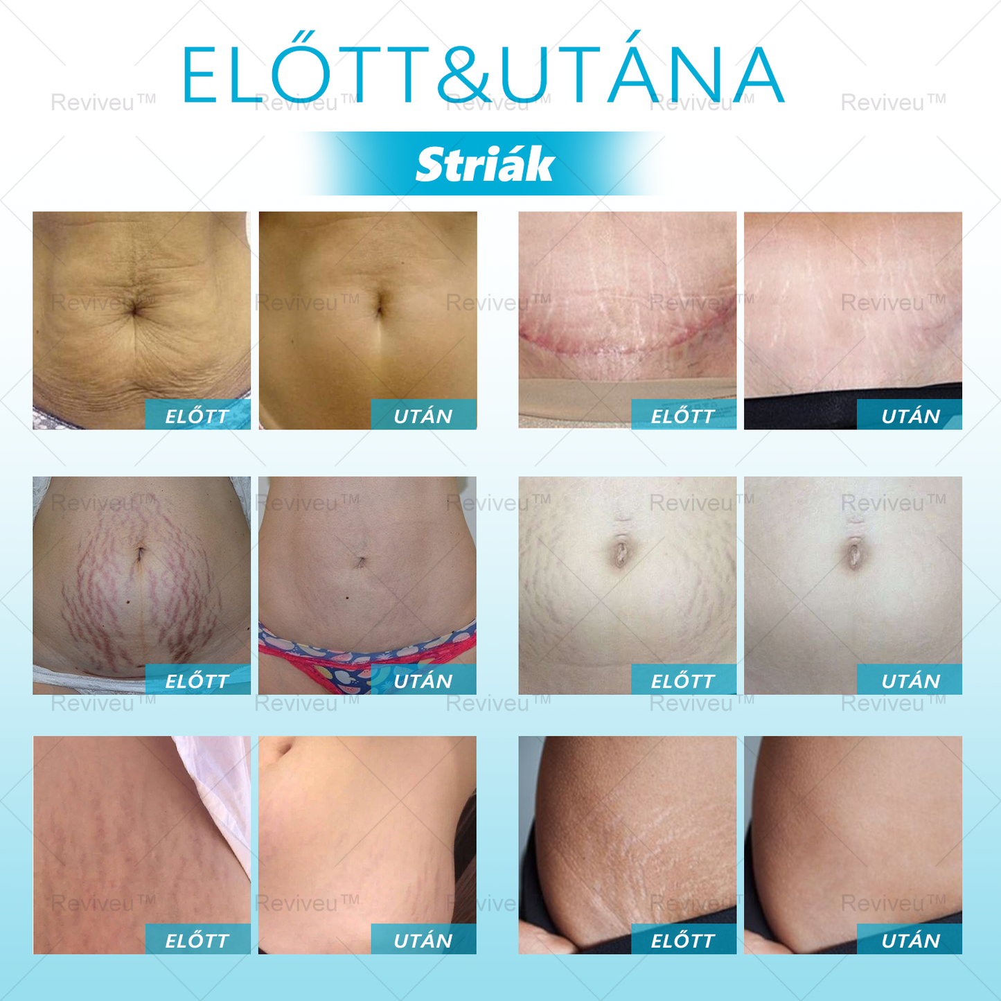 🐍🐍🐍Reviveu™ Revitalizáló Krém (Jelentős javulás 7 napon belül💯)