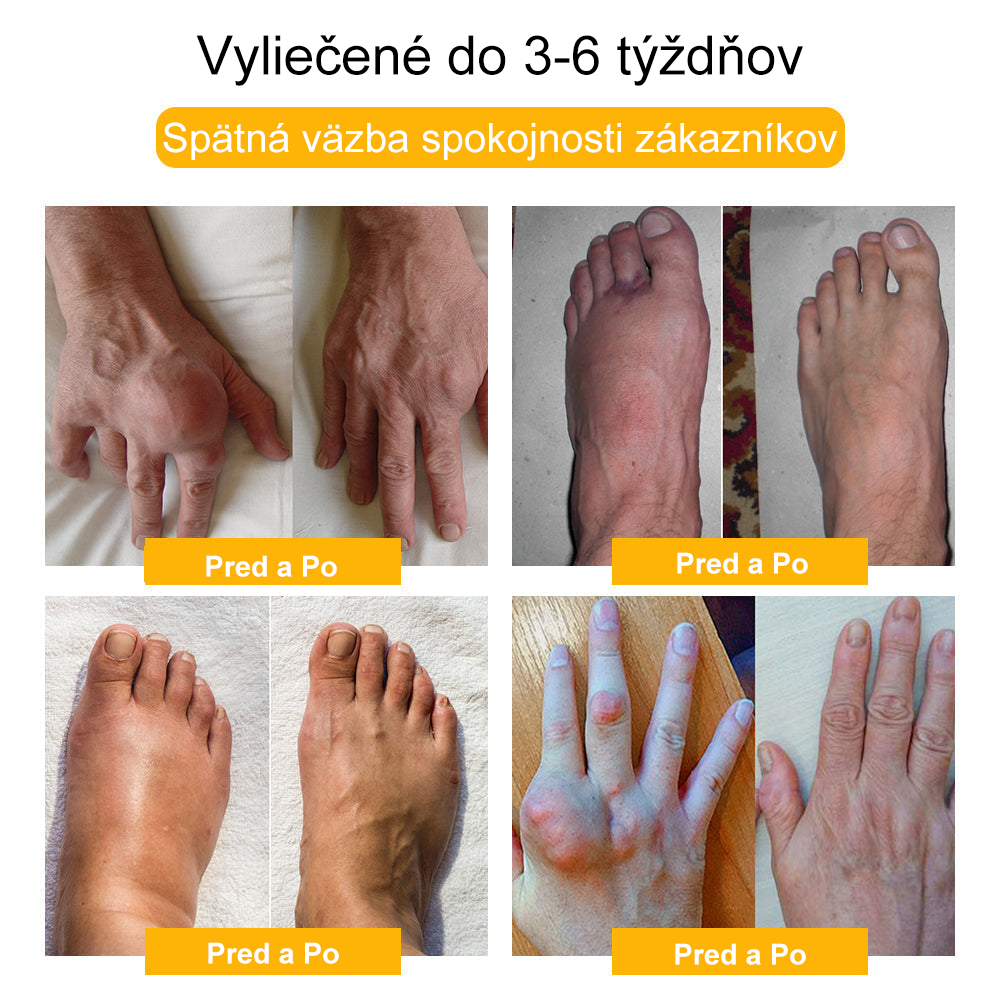 🔥🔥【Oficiálny značkový obchod】𝐀𝐫𝐭𝐫𝐨𝐅𝐥𝐞𝐱𝐢𝐬™ 𝐊𝐫é𝐦 𝐧𝐚 𝐫𝐞𝐠𝐞𝐧𝐞𝐫á𝐜𝐢𝐮 𝐤ĺ𝐛𝐨𝐯 𝐬 𝐯č𝐞𝐥í𝐦 𝐣𝐞𝐝𝐨𝐦(Extrakt z novozélandského včelieho jedu - špecializovaný na ortopedické ochorenia - Certifikovaný CE)