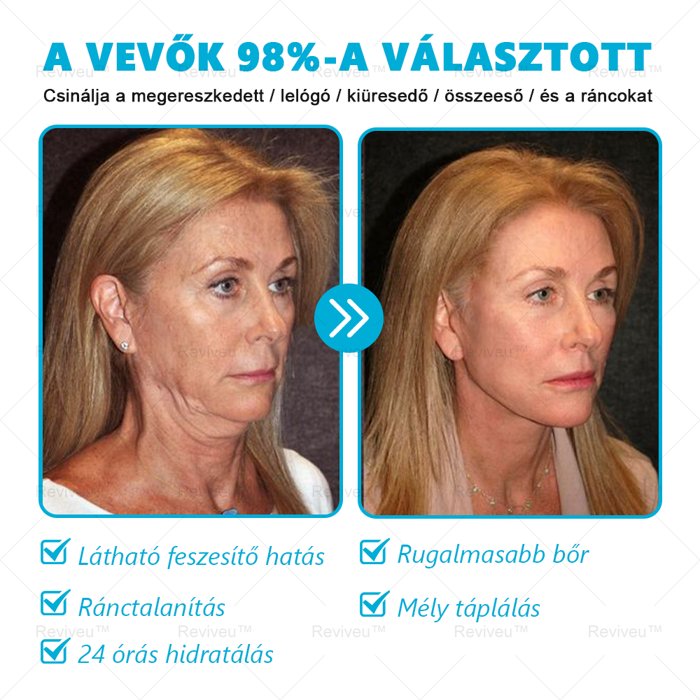 💗💗Reviveu™ Revitalizáló Krém(Jelentős javulás 7 napon belül💯)