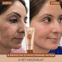 💟FRISSARC™ fehérítő és folteltávolító arcmaszk