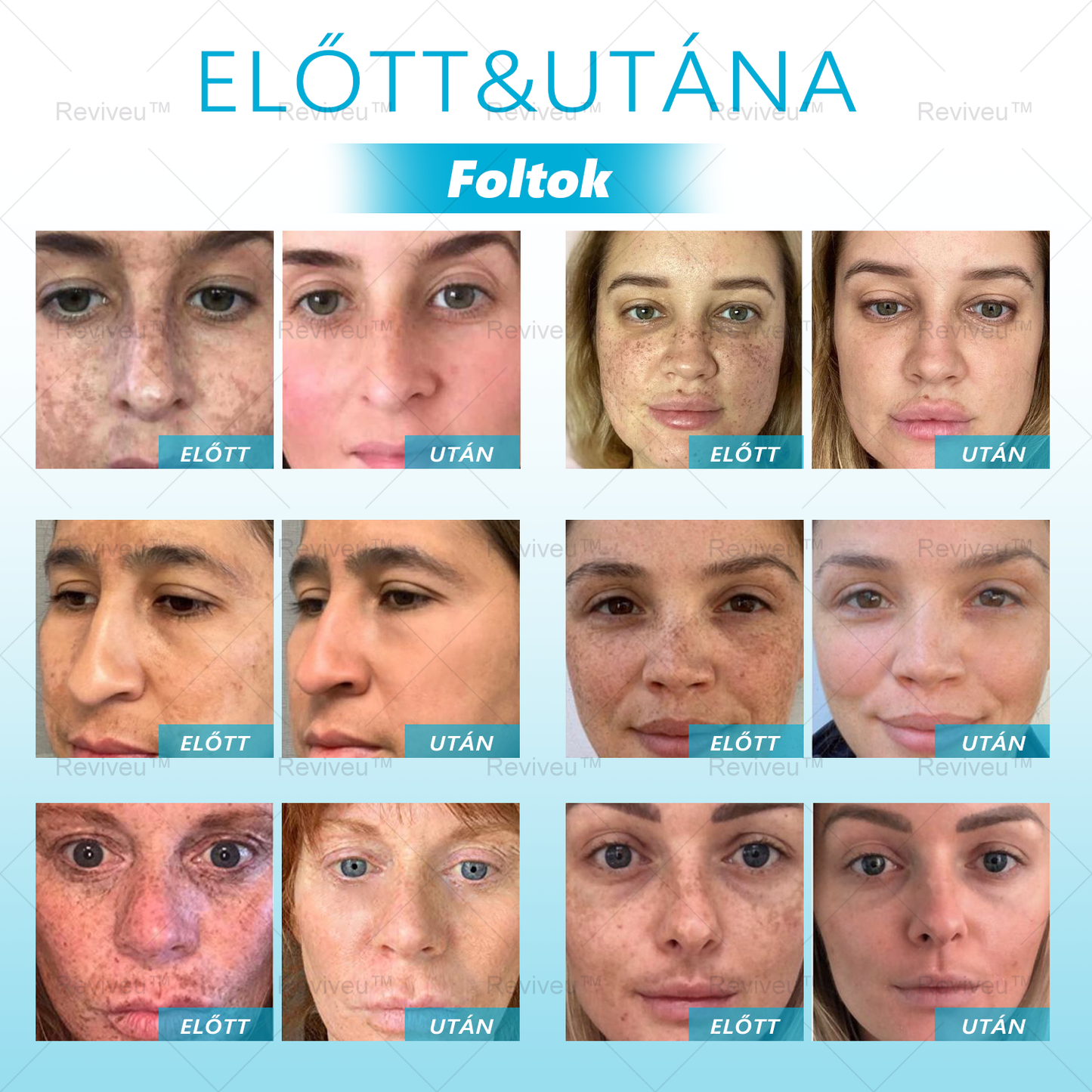 🐍Reviveu™ Revitalizáló Krém