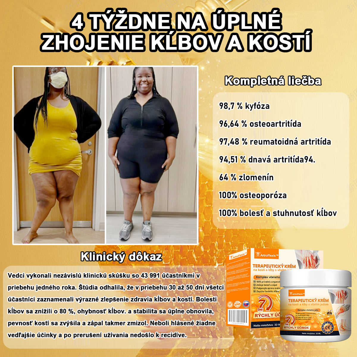 🔥🔥【Oficiálny značkový obchod】𝐀𝐫𝐭𝐫𝐨𝐅𝐥𝐞𝐱𝐢𝐬™ 𝐊𝐫é𝐦 𝐧𝐚 𝐫𝐞𝐠𝐞𝐧𝐞𝐫á𝐜𝐢𝐮 𝐤ĺ𝐛𝐨𝐯 𝐬 𝐯č𝐞𝐥í𝐦 𝐣𝐞𝐝𝐨𝐦(Extrakt z novozélandského včelieho jedu - špecializovaný na ortopedické ochorenia - Certifikovaný CE)