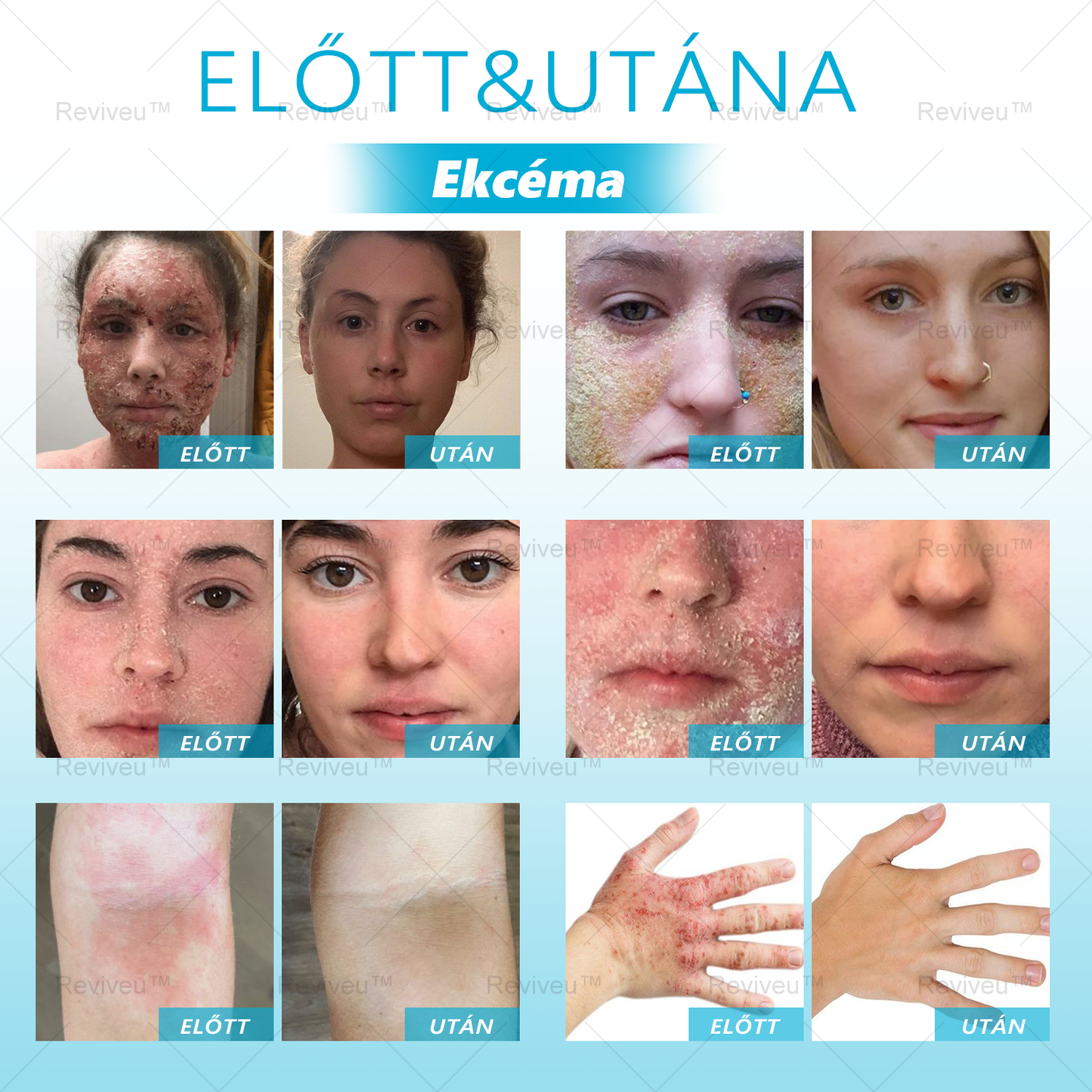 🐍Reviveu™ Revitalizáló Krém