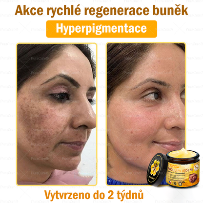 🌱 Odporúčané dermatológmi 🐝 ✨ PuraCure® Obnovujúci pleťový krém s včelím jedom 🔥 Český vývoj, výroba a doručenie v rámci Slovenska