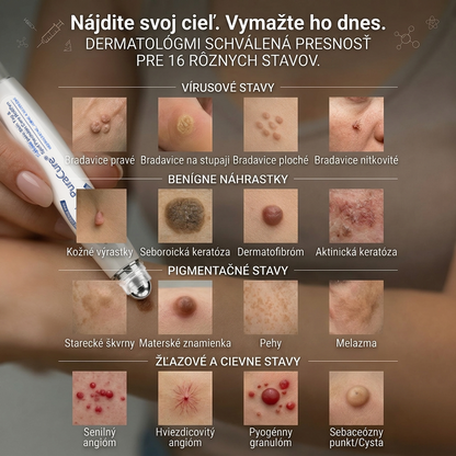 ✅PuraCure® 👩‍⚕️ 7-dňové pero na odstraňovanie kožných výrastkov a znamienok – bezbolestný a bez jaziev, profesionálny valčekový aplikátor