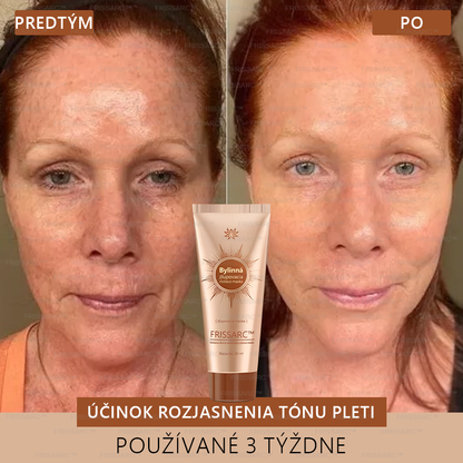 FRISSARC™ bieliaca a škvrny odstraňujúca pleťová maska – 🌿Prírodné zložky trvalo odstraňujú pigmentové škvrny, starecké škvrny, pehy a slnečné škvrny.