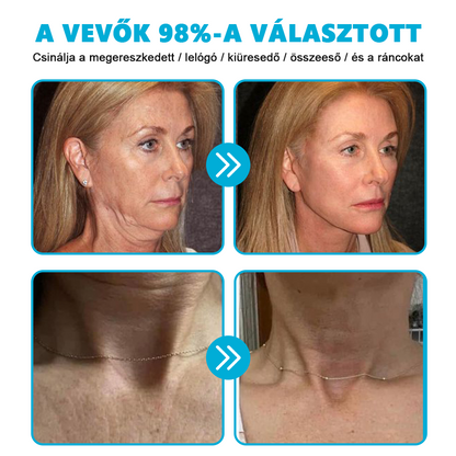 🐍🐍🐍Reviveu™ Revitalizáló Krém (Jelentős javulás 7 napon belül💯)