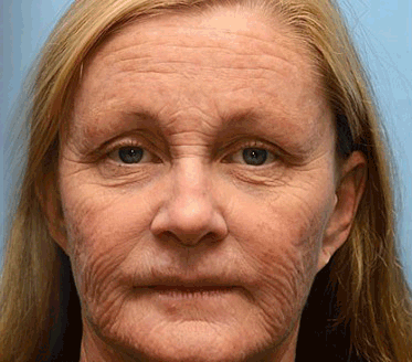 🐍Reviveu™ Revitalizáló Krém